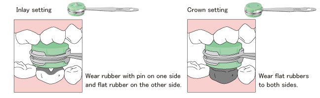 Inlay Crown Setter Set