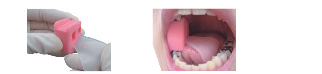 Mouth Prop with Tongue Guard 